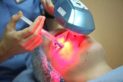 Laser biorevitalization of facial skin
