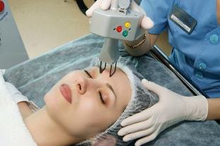 Fractional laser facial rejuvenation