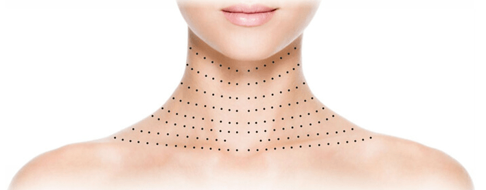 neck and décolleté how to renew